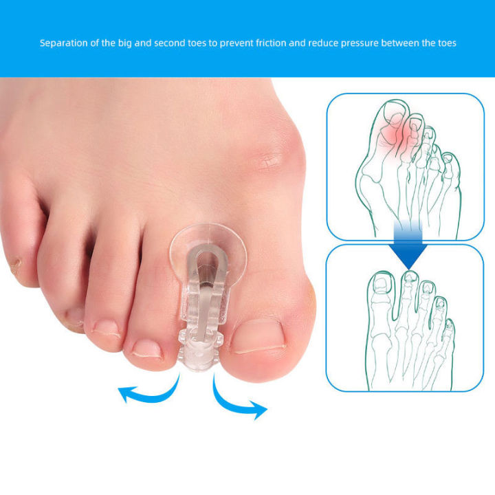 Toe Splitter Thumb Valgus Corrector Big Foot Bone Orthosis Clip Toe Pad Toe Over Yao Store