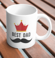 Best DAD Mugs / Dad love Mugs / Happy Father Day Mugs / Super Papa / Super Dad / Best gift for Father birthday / Dad Birthday / Father Love / Best Dad Ever / Best Dad in the world / Coffee Tea Mugs – Cups / 37 different customized design. 