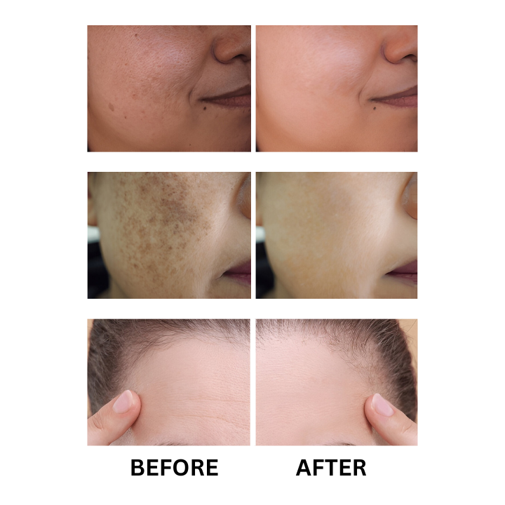 Reviticals%20Vitamin%20C%20Serum,%20Guaranteed%20Results%20plus%20Free%20sample.%20-%20Image%205