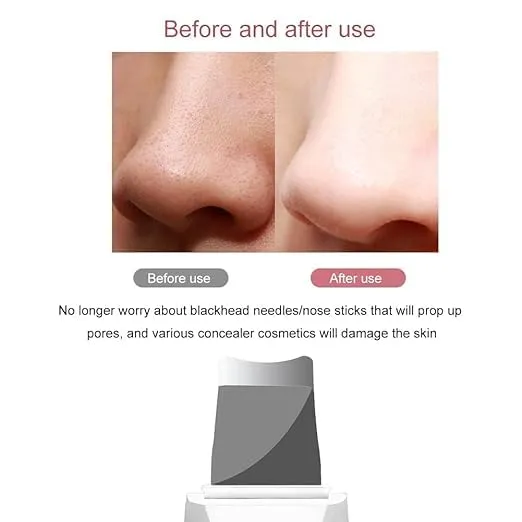 Ultrasonic%20Skin%20Scrubber%20Skin%20Care%20Machine%20Skin%20Massager%20Facial%20Pore%20Cleanser%20Peeling%20Shovel%20Lift%20Machine%20Vibration%20Removal%20Blackhead%20Cleansing%20Deep%20Face%20Cleaning%20Machine%20for%20Skin%20Care%20-%20Image%205