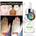 Vitamin C Serum, Pure Glow Serum for Face, Acne Scar Removal, Anti Aging Face Moisturizer & Anti Wrinkle Serum, Freckle Remover. 