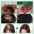 PURC Rosemary Oil Hair Growth Products for Man Women Ginger Anti Hair Loss Fast Regrowth Thicken Oils Scalp Treatment Hair Care BruberryBeD. 