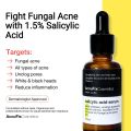 Salicylic Acid Serum (30ml) | Anti-acne | Acne Treatment. 