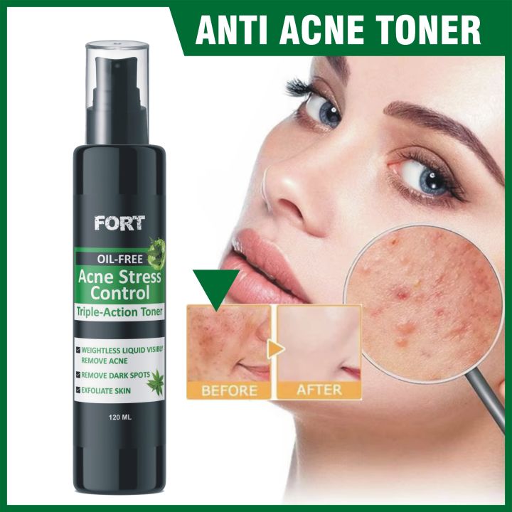 FORT Anti-Acne Dark Spots Removal Toner With Salicylic Acid 120ml