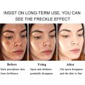 Yoxier Face Cream Dark Spot Corrector Anti-Aging Whitening Moisturizing Remove Sunburn Dark Spots and Acne Pigmentation 30g. 
