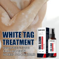Vitiligo Treatment Liquid Healthy White Tag Treatment Body Spray. 