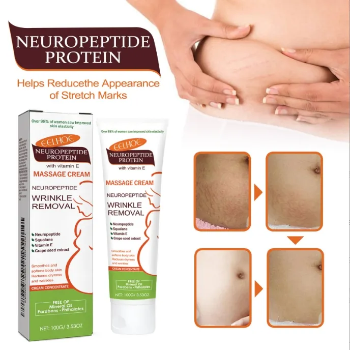 DISAAR%20Stretch%20Marks%20Removal%20Cream%20Anti%20Wrinkle%20Maternity%20Skin%20Repair%20Scars%20Mild%20Nourishing%20Massage%20Lotion%20Pregnancy%20Stretch%20Marks%20Removal%20Cream%20125g%20DS5402%20-%20Image%202