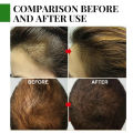 Rosemary Essential Oil Hair Growth Oils Pure Natural 30ML Hair Essential Oils For Nourish Shiny Hair Healthy Hair Care. 
