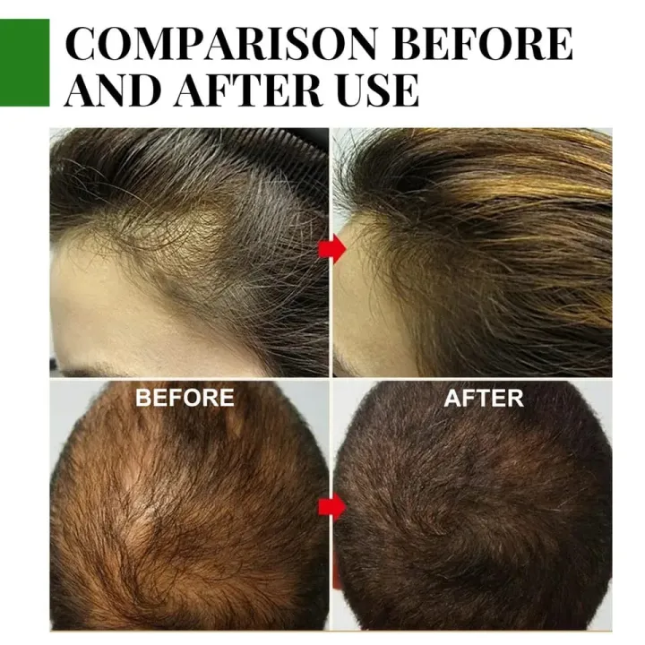 Rosemary%20Essential%20Oil%20Hair%20Growth%20Oils%20Pure%20Natural%2030ML%20Hair%20Essential%20Oils%20For%20Nourish%20Shiny%20Hair%20Healthy%20Hair%20Care%20-%20Image%204