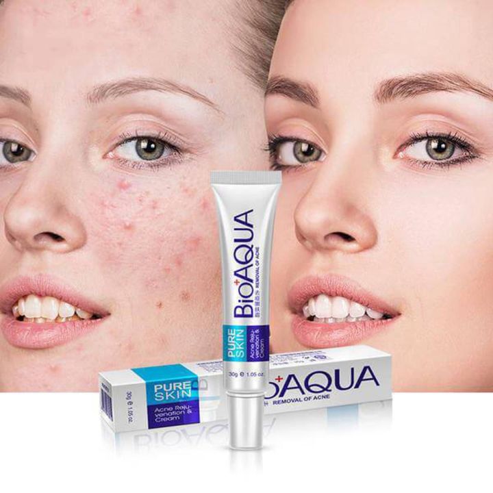 Bioaqua Pure Skin Acne Removal Anti-Wrinkle Treatment Cream.