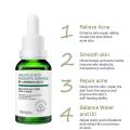ETAE Venzen Salicylic Acid Essence Acid Pore Moisturizing Face Serum. 