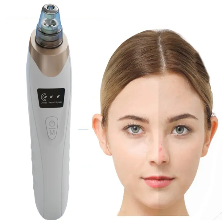 5%20in%201%20Electric%20Blackhead%20Remover%20-%20Oil%20Remover%20Machine%20-%20Black%20Head%20Remover%20-%20Dust%20Remover%20-%20Blackhead%20Remover%20Vacuum%20-%20Dirt%20Remover%20-%20Pore%20Vacuum%20Extractor%20-%20Blackhead%20Suction%20Device%20-%20Beauty%20tools%20-%20Clicked%20Now%20-%20Image%206