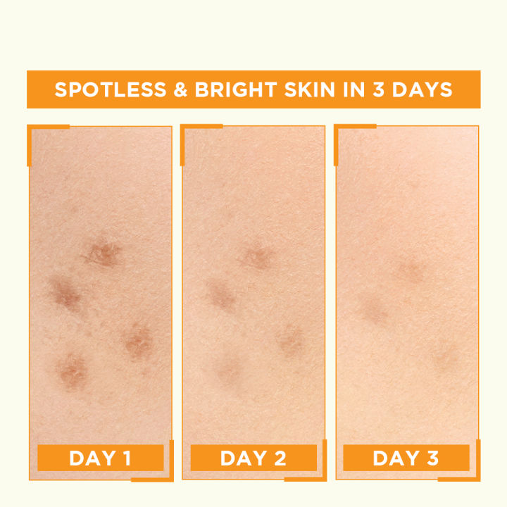 STYLZNGLAMZ%20%20Ulta%20Glow%20Whitening%20Organic%20Night%20Cream%2015gm%20%7C%20Anti-Aging%20Formula%20for%20Renewed,%20Luminous%20Skin%20Glow%20Whitening%20Organic%20Night%20Cream%2015gm%20-%20Anti%20Aging%20Night%20Cream%20-%20Skin%20Renewing%20Night%20Cream%20-%20Image%204