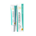 【Arrive within 48 hours】Shame tretinoin ointment, urea vitamin E cream, softening exfoliating acne cream, blackening. 