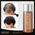 OEDO Ginseng Hair Growth Essence Preventing Hair Loss Liquid Damage Hair Repair Treatment Dense Fast Restoration Hair Growth 20ml. 