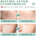 BIOAQUA Salicylic Acid Acne removal cleanser acne marks fading pores shrinking redness soothing oil controlling facial cleanser 100g BQY56297. 