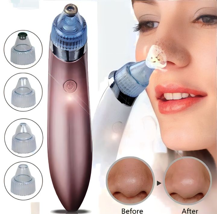 5 In 1 Rechargeable Blackhead Removal Machine Powerful Pimple Pore Cleaner Vacuum Suction Tool