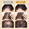 PURC Hair Growth Products for Men Women Biotin Collagen Anti Hair Loss Spray Fast Regrowth Thicken Scalp Treatment Hair Care RuoiasR. 