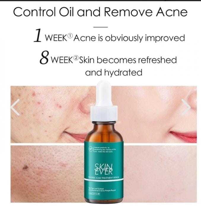 Private%20label%2030ml%20Tea%20tree%20acne%20essence%20is%20a%20pure%20natural%20tea%20tree%20extract%20that%20improves%20skin%20condition%20and%20heals%20the%20skin.%20-%20Image%202