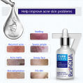 BIOAQUA Skin Care Acne Face Treatment 3 in 1 Acne Series (With Out Sheet Mask). 