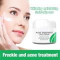 Anti Stains Acne Treatment Cream Scar Blackhead Face Cream Shrink Pores Whitening Skin Care Face Cream Korean Cosmetics. 