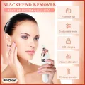 5-in-1 Blackhead remover, blackhead remover machine, derma suction, pimple acne remover, blackhead vacuum machine, dust remover, dirt remover, Pimple Popper Tool Pore Vacuum Black Head Remover, Whitehead Acne remover, deep face clean blackhead remover, fa. 