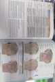 Moore’s Clinically Oriented Anatomy 9th Edition KLM Anatomy colour Book. 