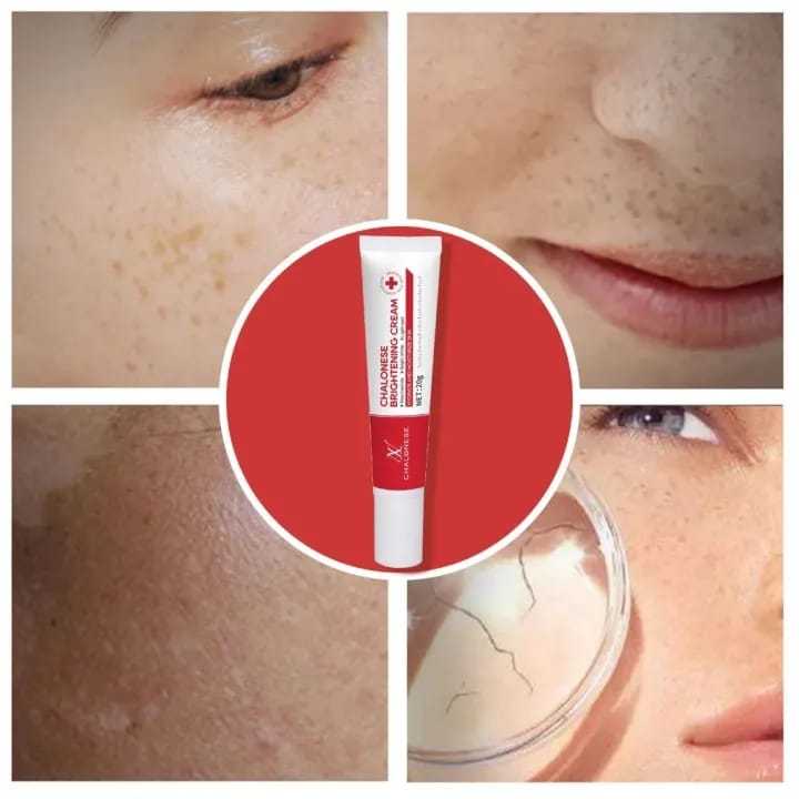 Chalonese%20Brightening%20Cream%2020g%20for%20Dark%20Spots%20&%20Pigmentation%20%7C%20Face%20Cream%20for%20Acne%20Marks,%20Sun%20Damage%20&%20Uneven%20Skin%20Tone%20%7C%20Daily%20Brightening%20Formula%20for%20Clear,%20Smooth%20&%20Naturally%20Radiant%20Skin%20-%20Image%205