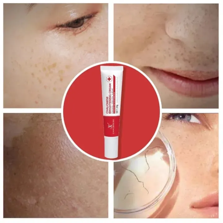 Chalonese%20Brightening%20Cream%2020g%20for%20Dark%20Spots,%20Pigmentation%20&%20Acne%20Marks%20%7C%20Advanced%20Skin%20Brightening%20Formula%20for%20Uneven%20Tone,%20Dull%20Skin%20&%20Melasma%20%7C%20Daily%20Face%20Cream%20for%20Visible%20Glow%20-%20Image%202