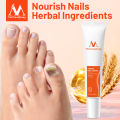 MeiYanQiong Herbal Nail Treatment Onychomycosis Paronychia Anti Fungal Nail Infection Good Result Chinese Herbal Toe Nail Fungus Treatment. 