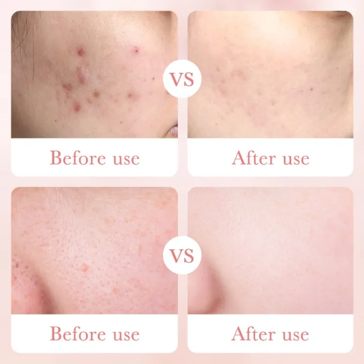 Bioaqua%20Rose%20Hyaluronic%20Acid%20Moisturizing%20Anti%20Aging%20Face%20Lotion%20100ml%20-%20Image%206