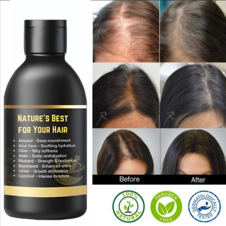 8in1%20Herbal%20Hair%20Oil%20%7C%208%20in%201%20Natural%20Hair%20Oil%20with%20Almond,%20Aloe%20Vera,%20Olive,%20Amla,%20Mustard,%20Black%20Seed,%20Onion%20&%20Coconut%20Oil%20%E2%80%93%20Hair%20Growth%20Oil,%20Anti%20Hair%20Fall,%20Anti%20Dandruff,%20Nourishing%20Treatment%20for%20Strong,%20Long,%20Shiny%20&%20Healthy%20Hair%20%E2%80%93%20100ML/60ML%20-%20Image%203