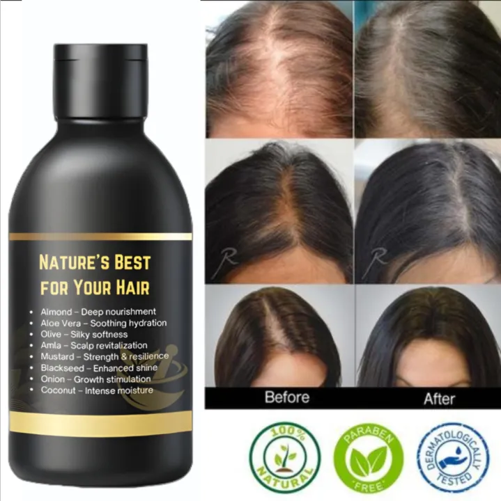 8in1%20Herbal%20Hair%20Oil%20with%20Almond,%20Aloe%20Vera,%20Olive,%20Amla,%20Mustard,%20Black%20Seed,%20Onion%20&%20Coconut%20Oil%20-%20Powerful%20Hair%20Treatment%20for%20Anti%20Hair%20Fall,%20Anti%20Dandruff,%20Hair%20Growth%20&%20Nourishment%20-%20Essential%20for%20Shiny%20&%20Healthy%20Hair%20Care,%20100ML/60ML%20PROMISE%20TO%20SELL%20-%20Image%204