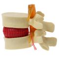 Lumbar Vertebrae Model Anatomical Spine Lumbar Disc Herniation Anatomy Teaching Tool Lumbar Vertebrae Model. 