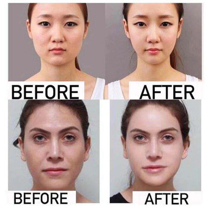 Face%20Shaper%20Lift%20Up%20Belt%20-%20Black%20-%20Image%204