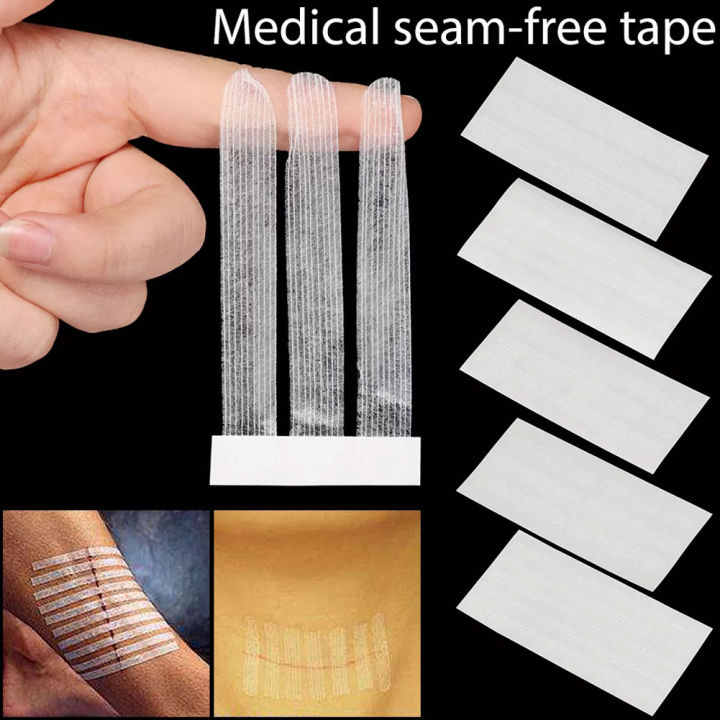 【HOT】 1 Set 5 Sizes Seam-Free Medical Tape Surgery Postpartum Skin Wound Strip Pull-On Tight Anti-Speed First Aid Safety Beauty Tapes
