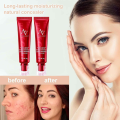 FV Makeup Foundation Acne Concealer Face Skin Care Cream Full Facial Coverage Cream Cosmetic Liquid Foundation 30 mg FV Foundation. 
