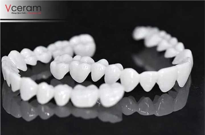 Perfect%20Smile%20Snap-On%20Veneers%20%E2%80%93%20Realistic%20Silicone%20Denture%20Covers%20for%20Upper%20&%20Lower%20Teeth%20-%20Image%206