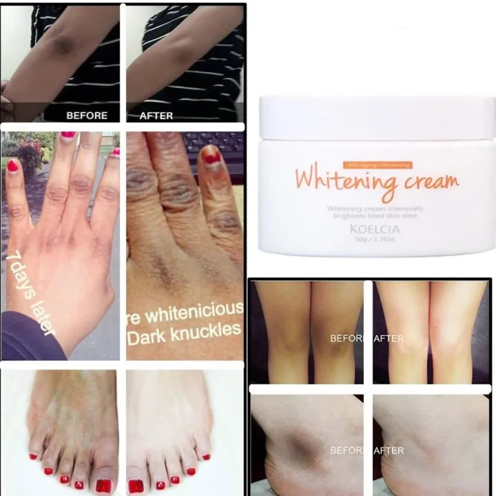WHITENING%20CREAM%20skin%20lightening%20FOR%20intimate%20area%20private%20parts%20vigin..a%20under%20arm%20-%20Image%205