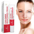 Chalonese Brightening Cream 20g for Acne Marks & Pigmentation | Daily Face Cream for Uneven Skin Tone, Dark Patches & Dullness | Gentle Formula for Smooth, Clear & Radiant Skin. 