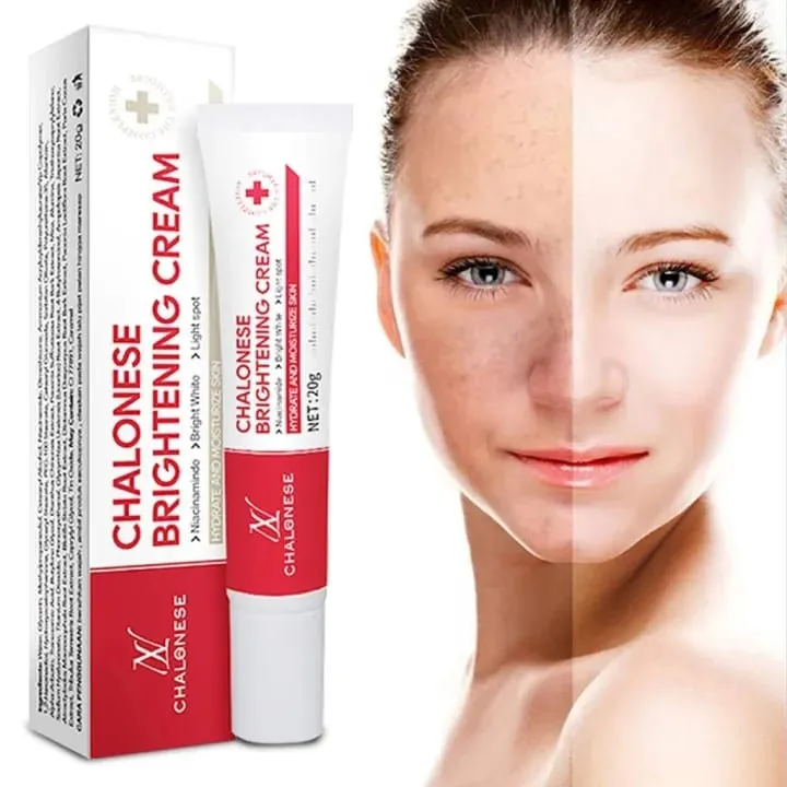 Chalonese%20Brightening%20Cream%2020g%20for%20Acne%20Marks%20&%20Pigmentation%20%7C%20Daily%20Face%20Cream%20for%20Uneven%20Skin%20Tone,%20Dark%20Patches%20&%20Dullness%20%7C%20Gentle%20Formula%20for%20Smooth,%20Clear%20&%20Radiant%20Skin%20-%20Image%202