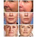 5 Seconds Retinol Wrinkle Remover Face Cream Anti-Aging Firm Lifting Fade Fine Line Improve Puffiness Whiten Women Men Skin Care. 