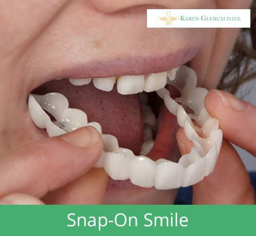 Snap-On%20Teeth%20Veneers%20for%20Upper%20&%20Lower%20%7C%20Comfortable%20Silicone%20Denture%20Covers%20%7C%20Instant%20Smile%20Braces%20-%20Image%205