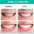 Snap-On Teeth Veneers for Upper & Lower | Comfortable Silicone Denture Covers | Instant Smile Braces. 