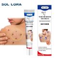 SOL LORA Cross-Border Amazon AliExpress Wart-Removing Cream Wart-Removing Flat Wart-Removing Silk Wart Cream Corns Mole Remover Cream. 