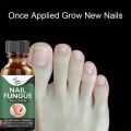100% Original Nail Fungus Treatment Stop Fungal Growth Effective Fingernail 10ml. 