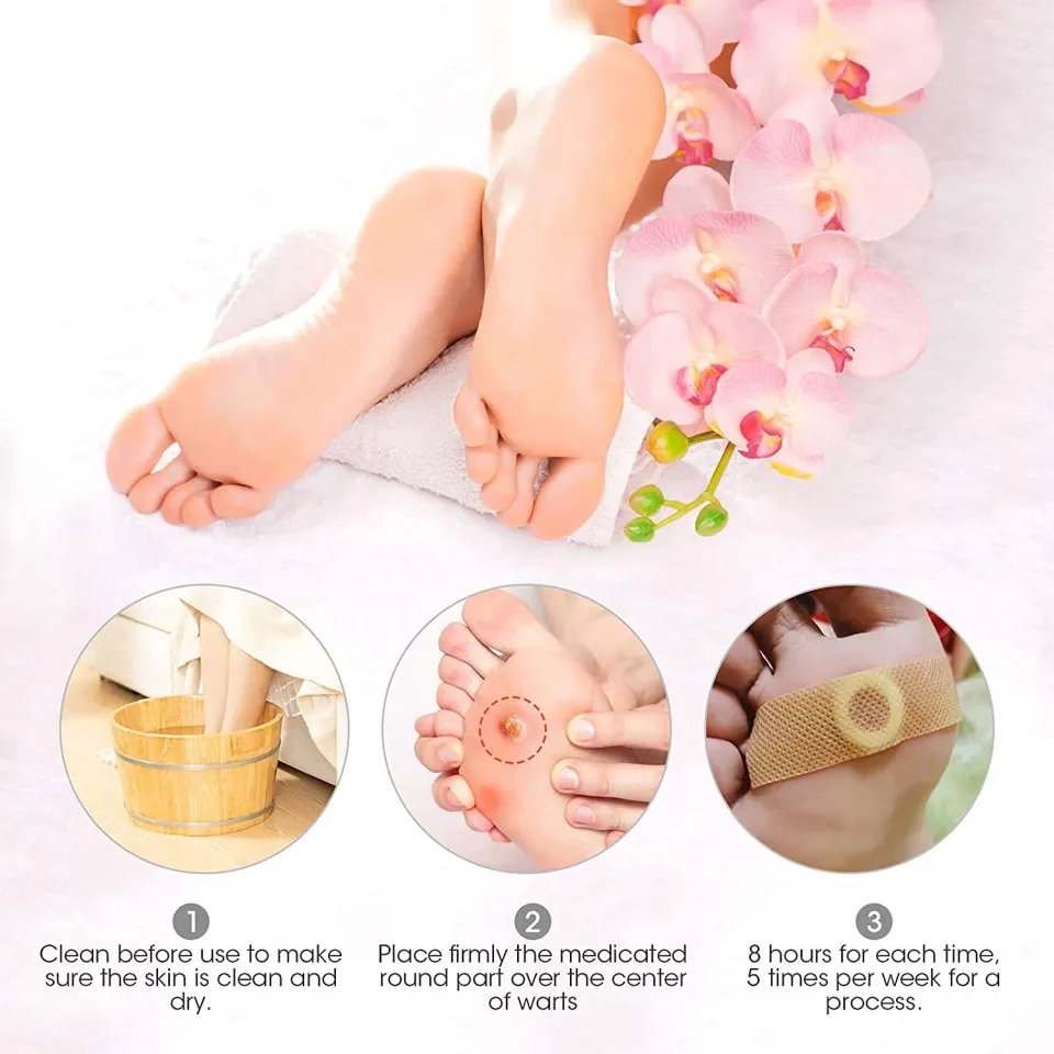 Corn Feet Remover, Toe Corn and Callus Removal, Best Corn Remover