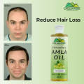 Amla Oil  Promotes Hair Growth, Reduce Dandruff & Prevent Graying Of Hair. 
