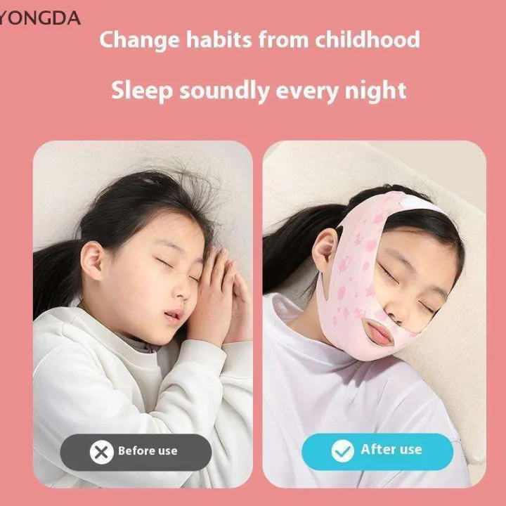 YONGDA%20Anti-Snoring%20Strap%20Facial%20Skin%20Lifting%20Close%20Mouth%20Reduce%20Health%20Care%20Beauty%20Tool%20Stop%20Snoring%20Belt%20For%20Kids%20-%20Image%206