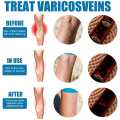 30ml Vein Healing Varicose Veins Treatment Spray Essential Oil Relief Phlebitis Angiitis Remedy Pain Spray Relief Leg Pain Spine Pain. 